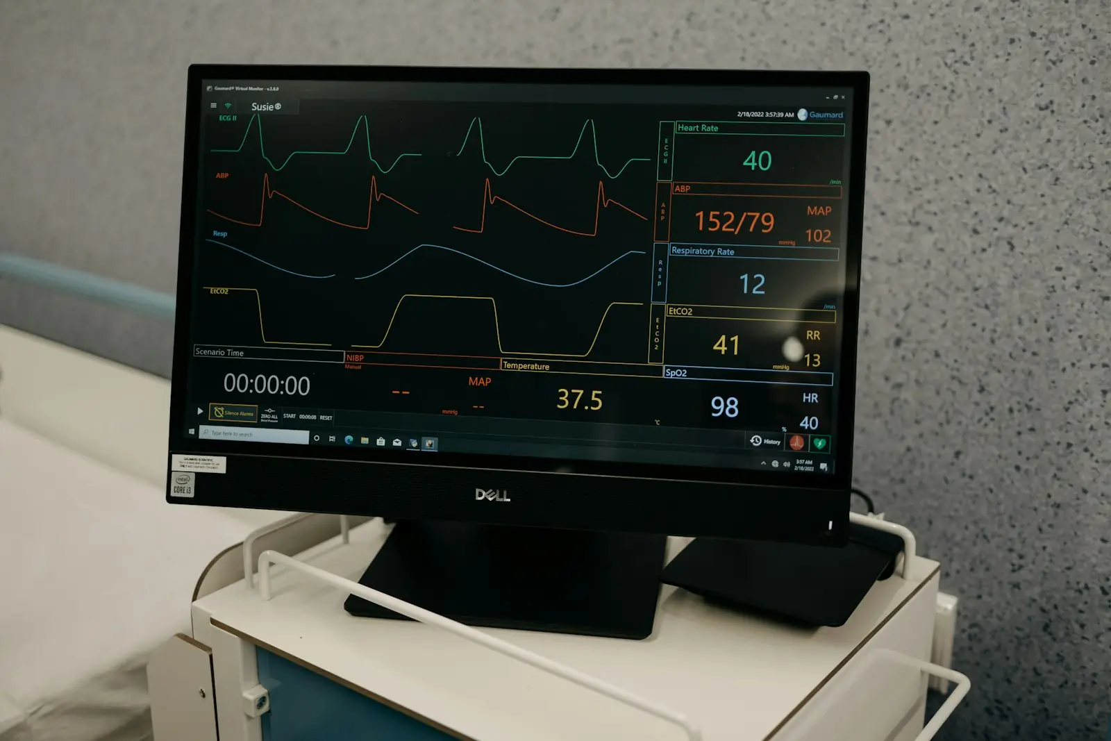 A monitor showing live charts